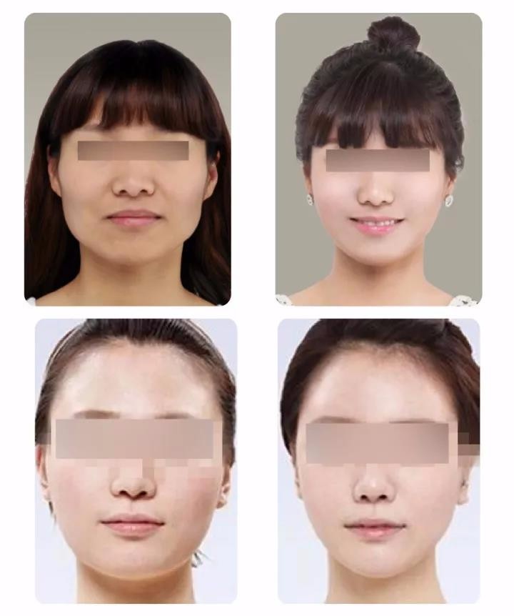 【昆山铂特丽整形】"女神自测图"5条标准,成功4条及以上才配叫女神